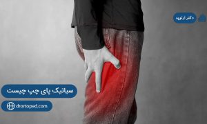 سیاتیک پای چپ