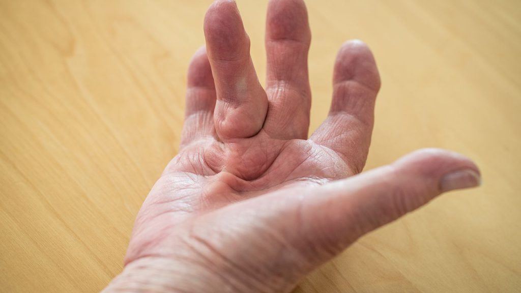 درد انگشت کوچک دست