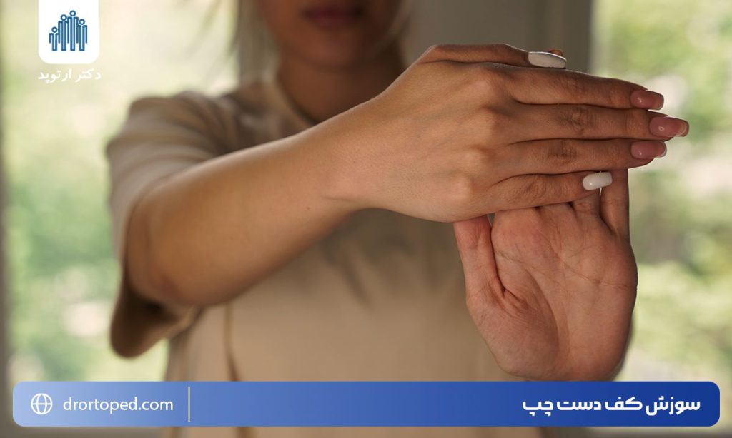 سوزش کف دست چپ