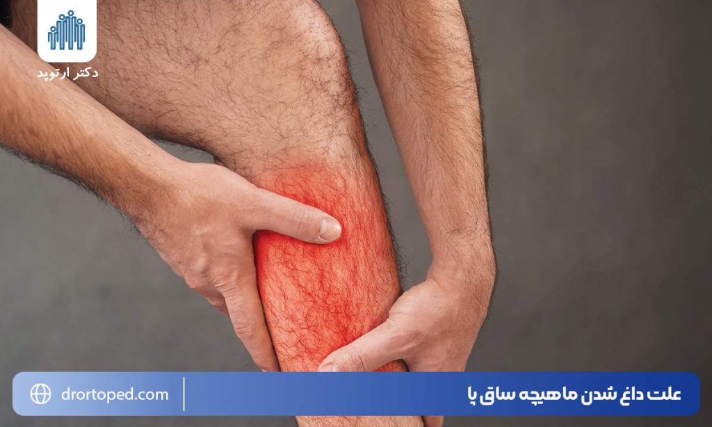 علت داغ شدن ماهیچه ساق پا