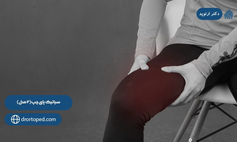 سیاتیک پای چپ